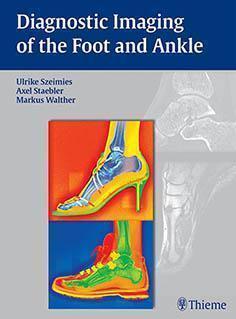 DIAGNOSTIC IMAGING OF THE FOOT AND ANKLE 2015 - رادیولوژی